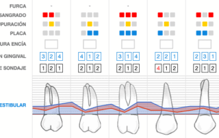 Periodontograma Nubimed